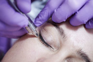 Diamant Microdermabrasion